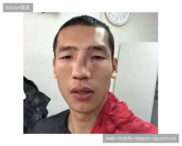 选手鼻骨疑似断裂仍坚持：体育精神的最强诠释